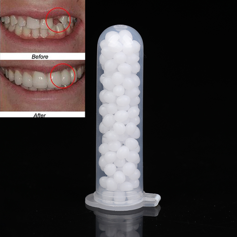 【K】1 Kotak Kit Perbaikan Gigi  - Teeth Whitening Kit ulasan dan harga