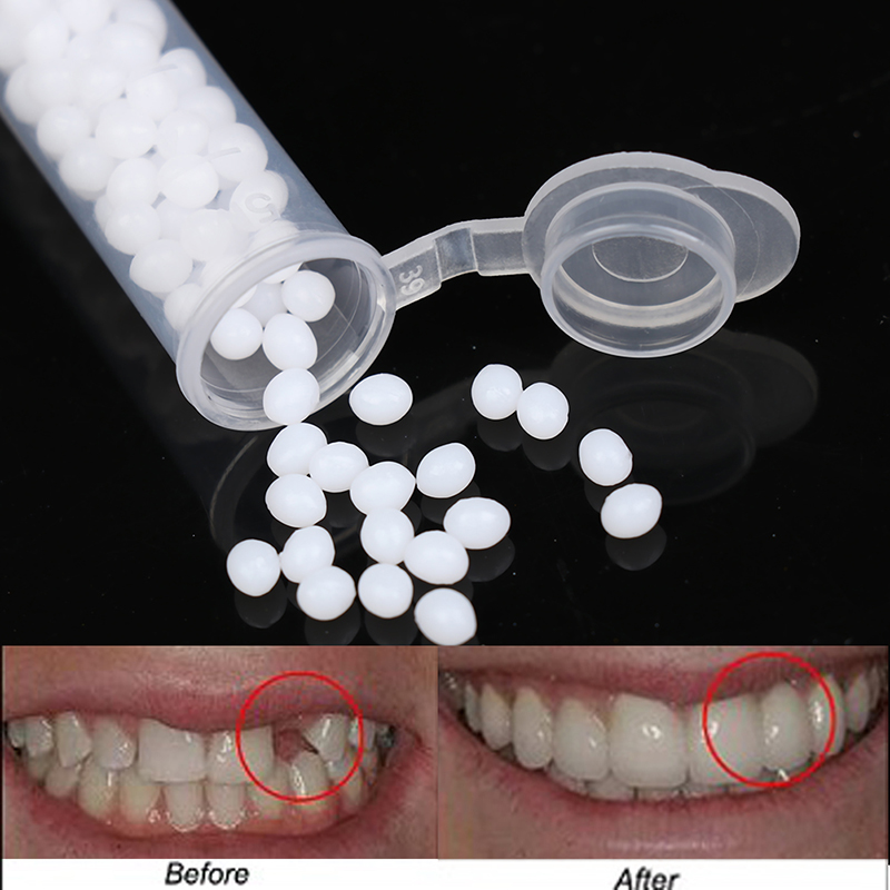 【K】1 Kotak Kit Perbaikan Gigi  - Teeth Whitening Kit ulasan dan harga