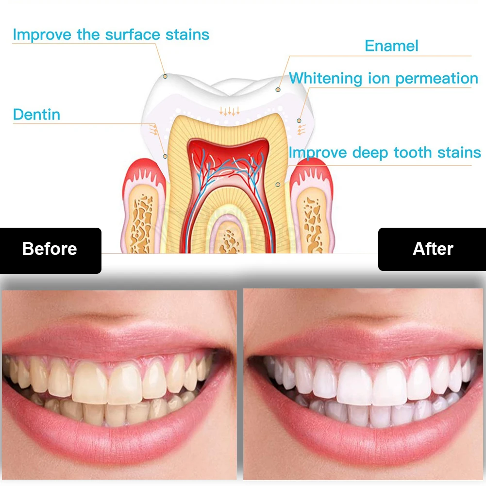Kit pemutih gigi Mini 16 LED c - Teeth Whitening Pens ulasan dan harga